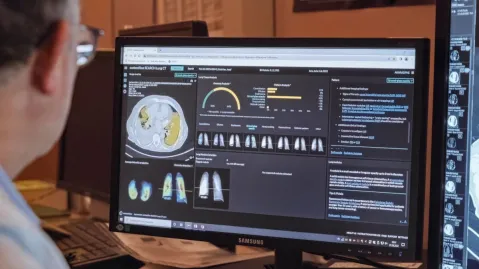 person sitting in front of screen showing contextflow application